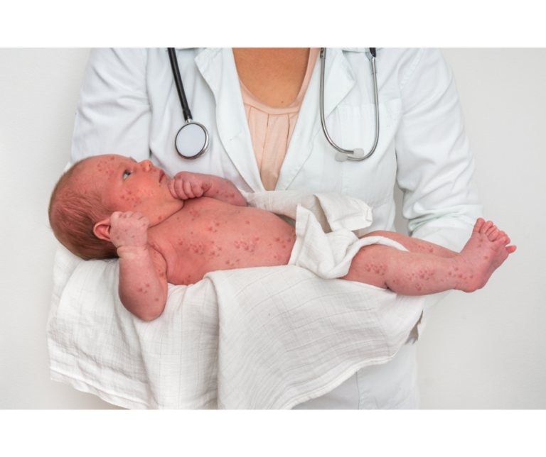 _Informative Darstellung über Ringelröteln und ihre Auswirkungen auf Kinder